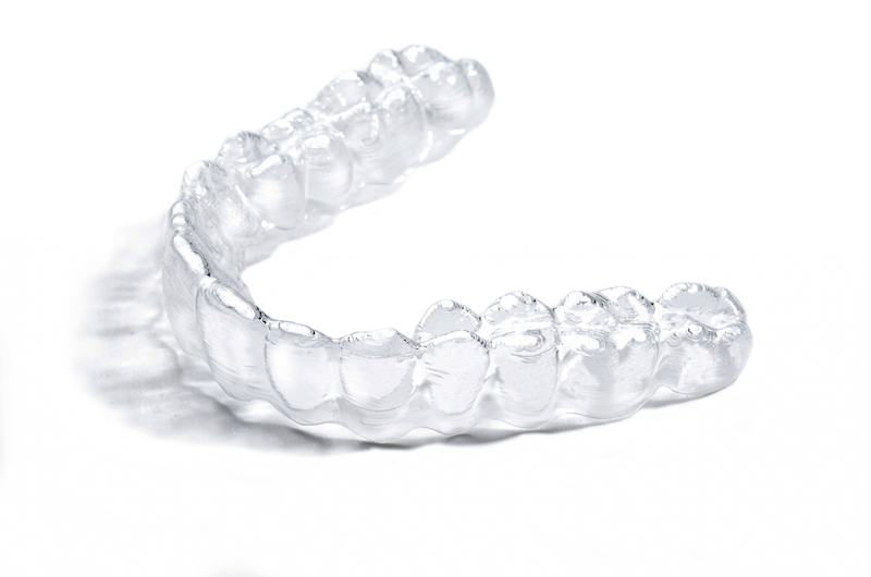 Invisalign y planificación digital: ver tu sonrisa antes de empezar